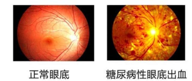 眼科中西医诊断对照_电动道闸 系统系统智能_眼科智能诊断系统