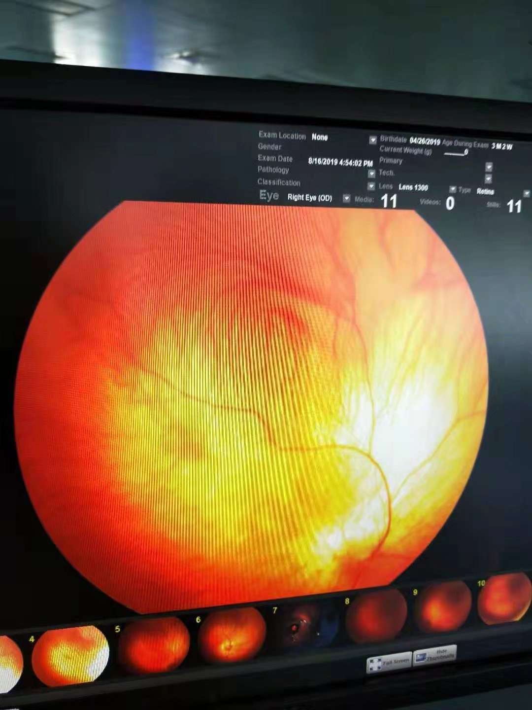 眼科智能诊断系统_智能电表 报文 诊断_先导智能股票诊断