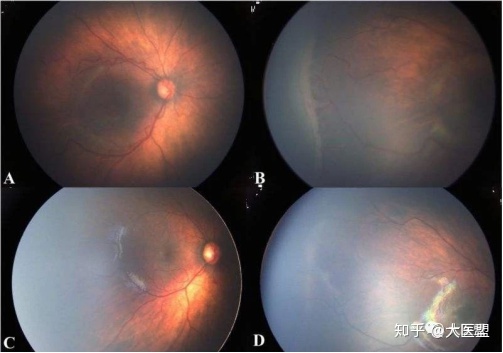 眼科智能诊断系统_先导智能股票诊断_智能电表 报文 诊断
