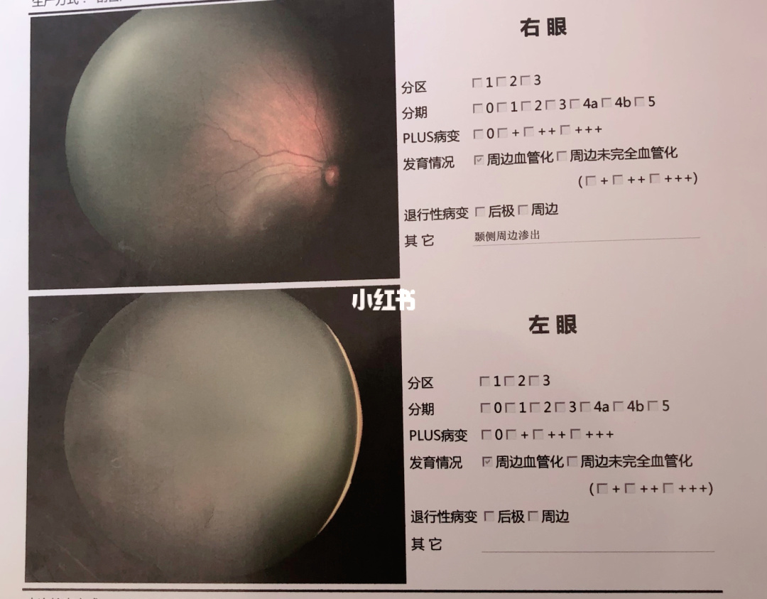 智能电表 报文 诊断_先导智能股票诊断_眼科智能诊断系统