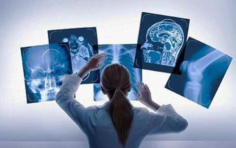 gtac下载吉利问诊系统_人工智能问诊系统_电动道闸 系统系统智能