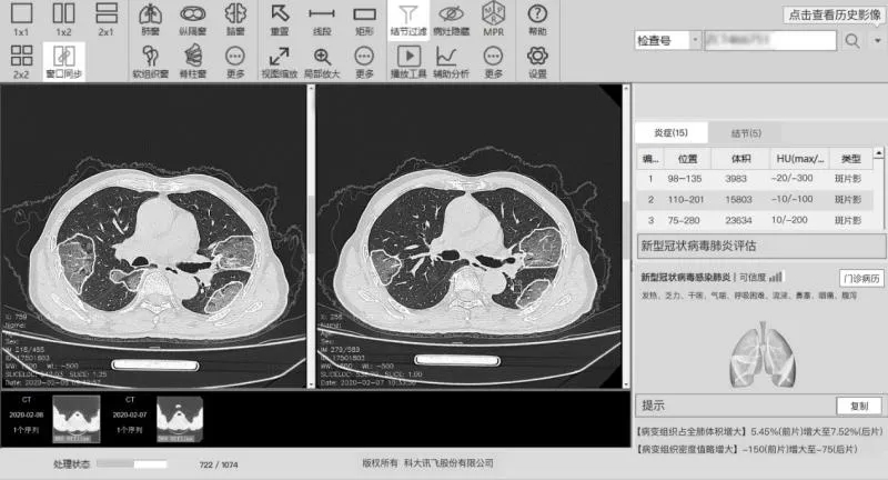 北京纹眉艺星问诊_自动问诊_隆胸假体取出问诊藝星