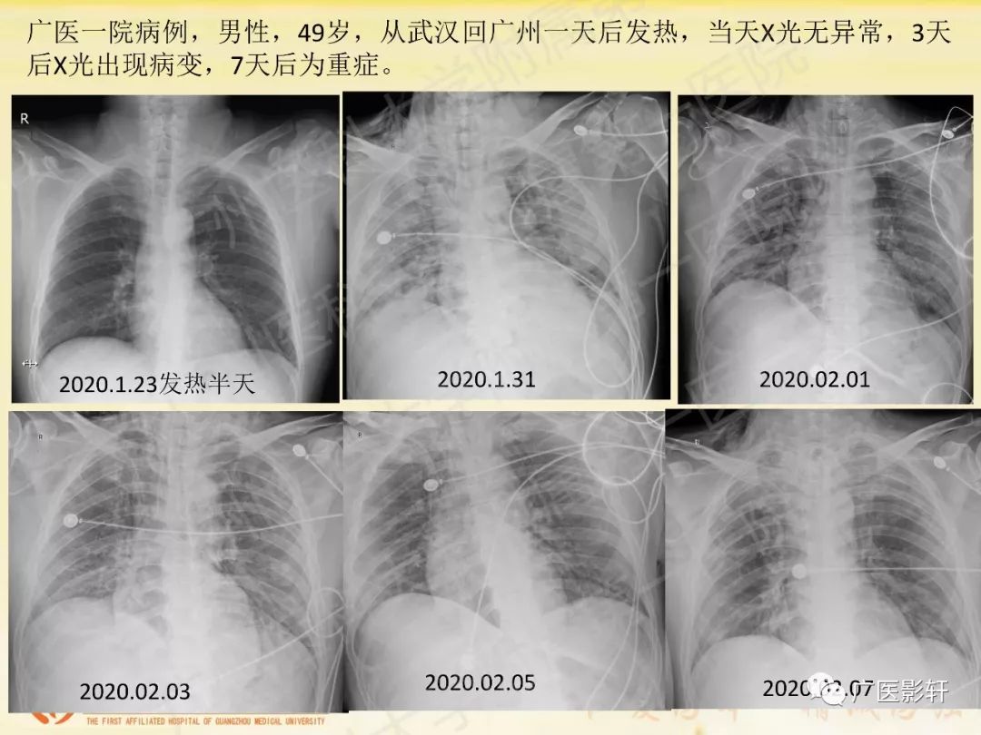 隆胸假体取出问诊藝星_北京纹眉艺星问诊_自动问诊
