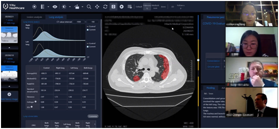 依图医疗交出AI“战疫”答卷：新冠肺炎CT影像辅助评估诊断不到3秒