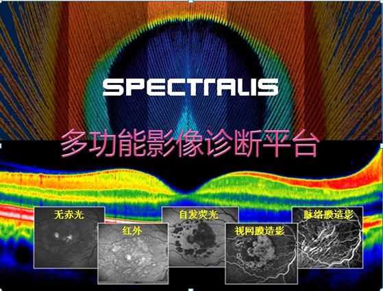 眼底AI日渐成熟，医疗产业为何“毫无反应”？