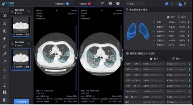 什么是互联网问诊_互联网问诊开方_互联网问诊需要什么资质吗