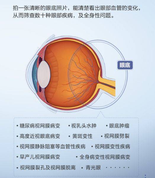 眼科人工智能诊断_眼科智能诊断系统_智能眼科概论