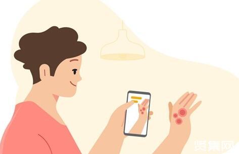 谷歌将于年内推出AI皮肤病检测APP，实现AI网络问诊